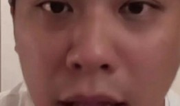 葛斯齐最新爆料汪小菲得病了,豪门生活背后的健康危机？”